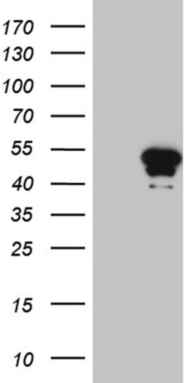 HOXD9 Antibody in Western Blot (WB)