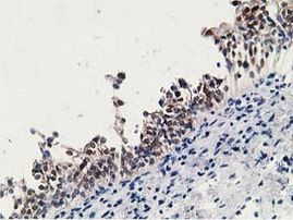 HPGD Antibody in Immunohistochemistry (Paraffin) (IHC (P))