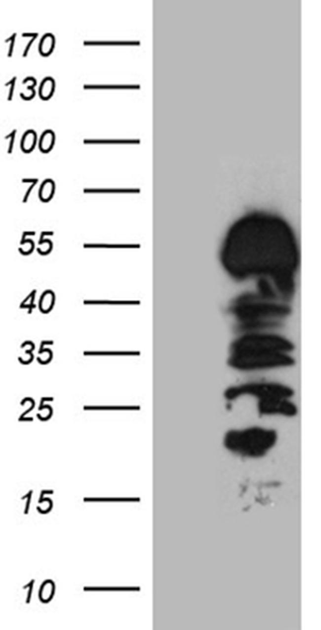 HS1BP3 Antibody in Western Blot (WB)