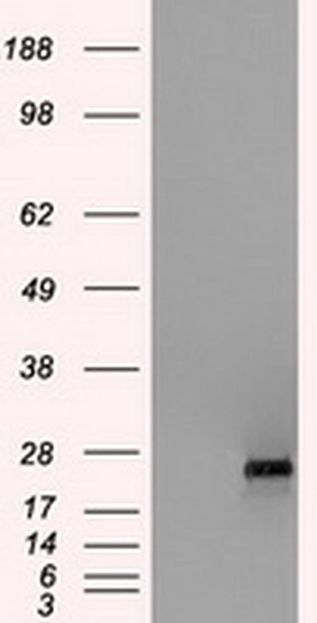 HSD17B10 Antibody in Western Blot (WB)