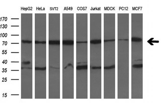 HSPA9 Antibody in Western Blot (WB)
