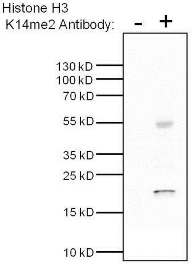 H3K14me2 Antibody in Immunoprecipitation (IP)