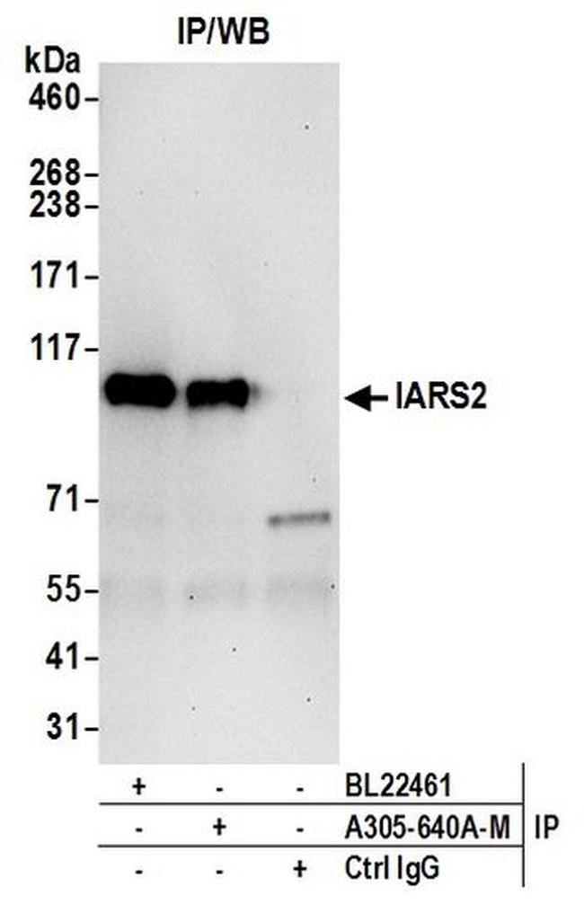IARS2 Antibody in Western Blot (WB)