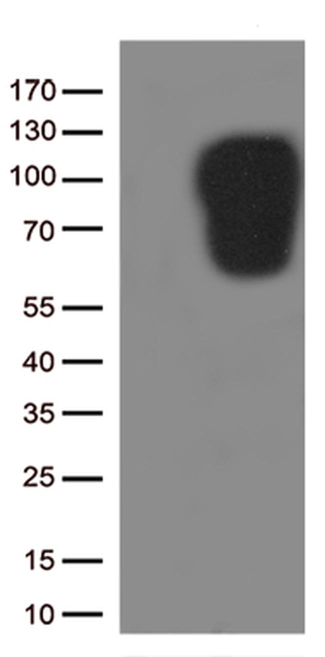 ICAM1 Antibody in Western Blot (WB)