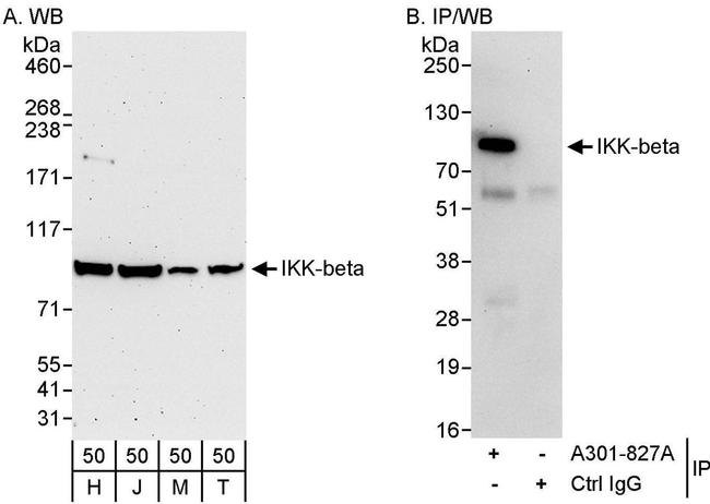 IKK-beta Antibody in Western Blot (WB)