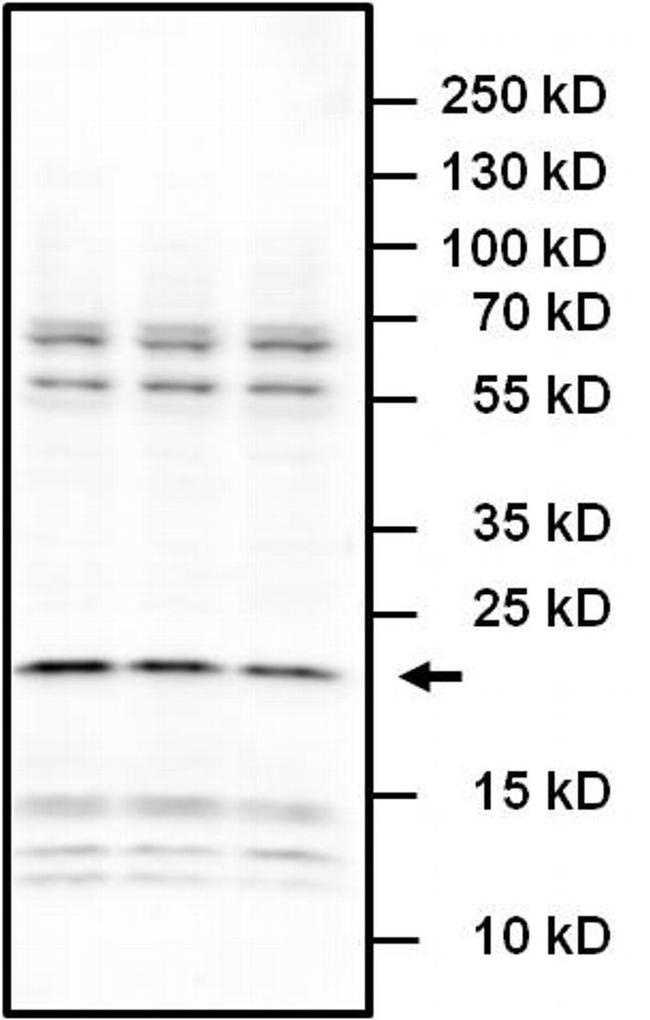 IL-6 Antibody in Western Blot (WB)