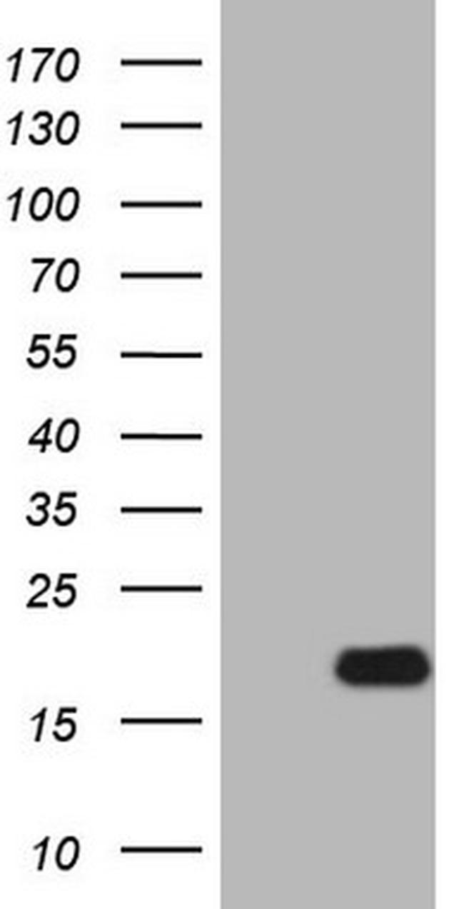 IL15 Antibody in Western Blot (WB)