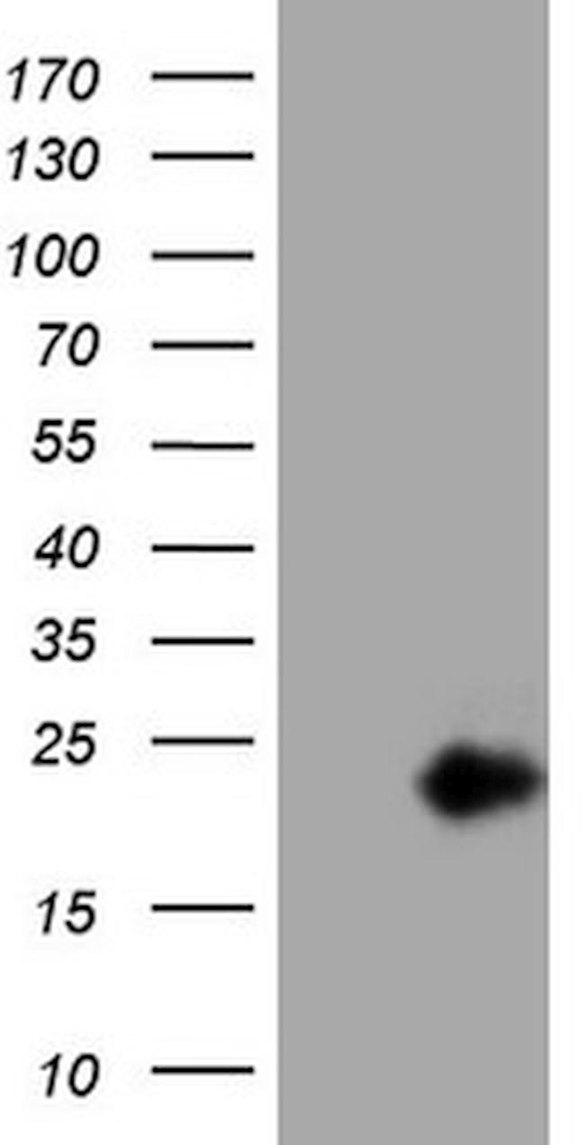 IL15 Antibody in Western Blot (WB)