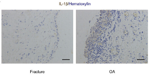 IL1B Antibody in Immunohistochemistry (Paraffin) (IHC (P))