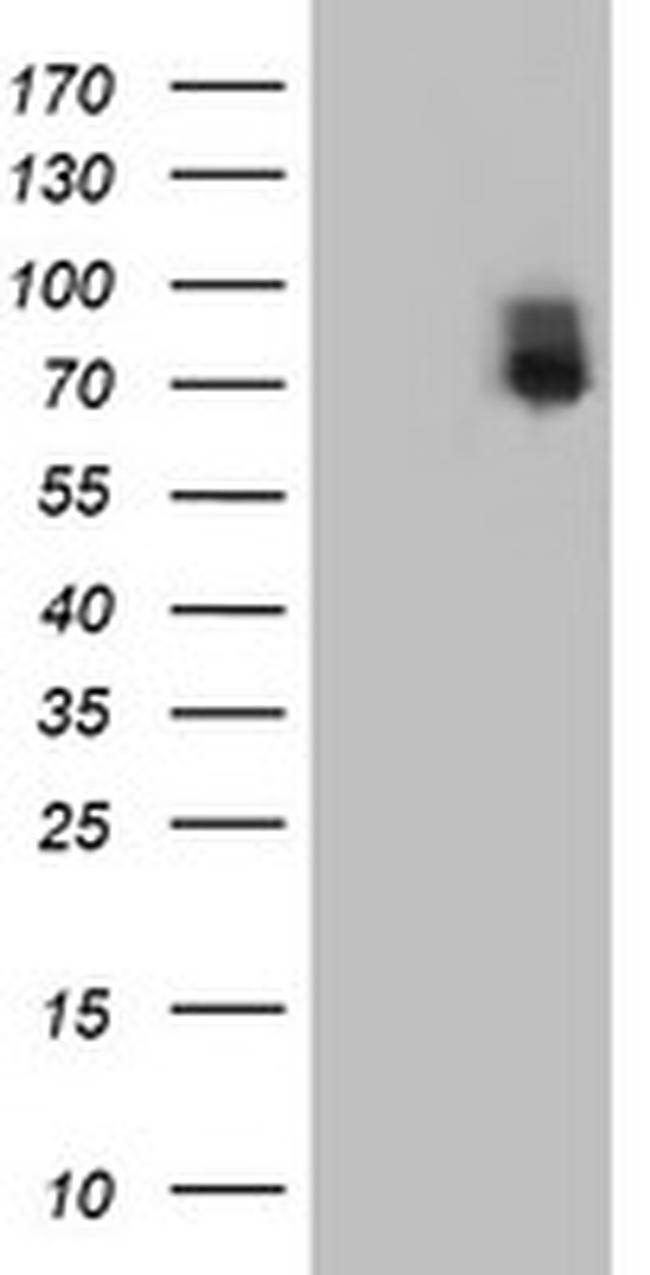 ILVBL Antibody in Western Blot (WB)