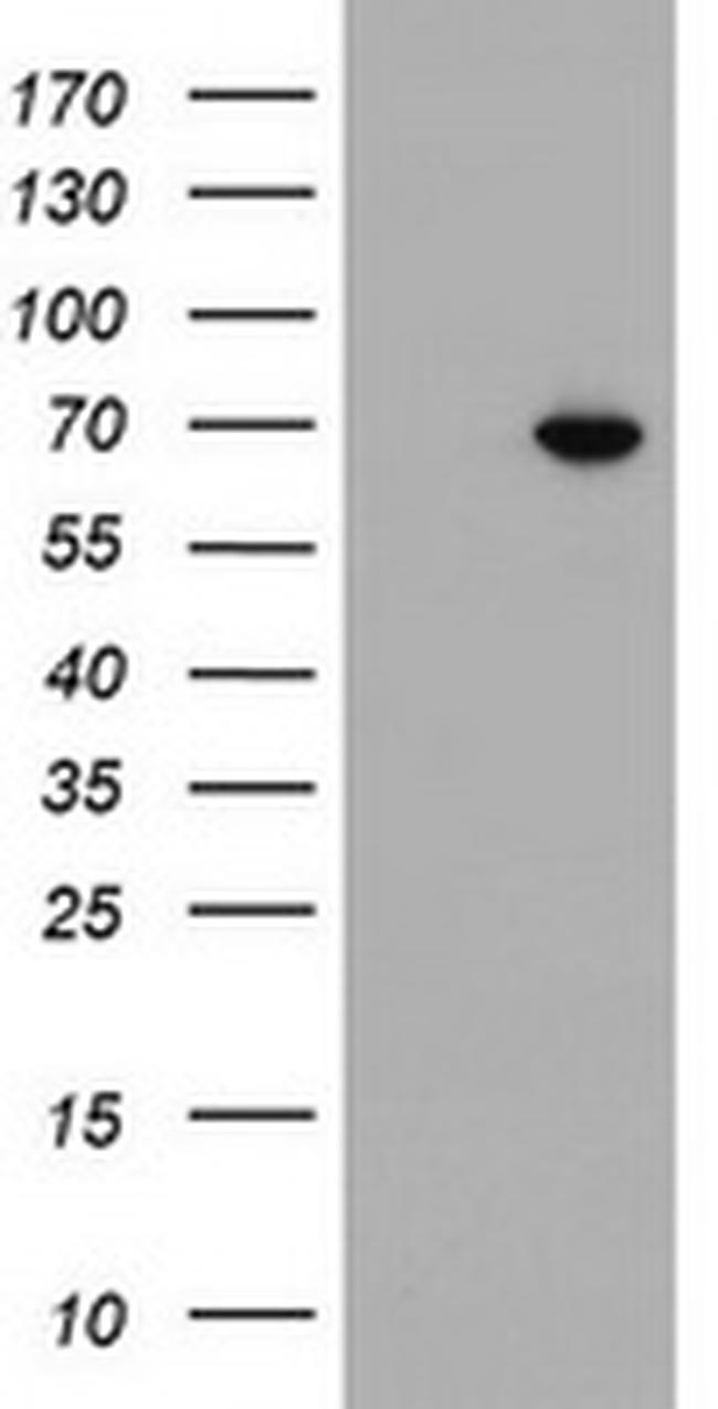 ILVBL Antibody in Western Blot (WB)