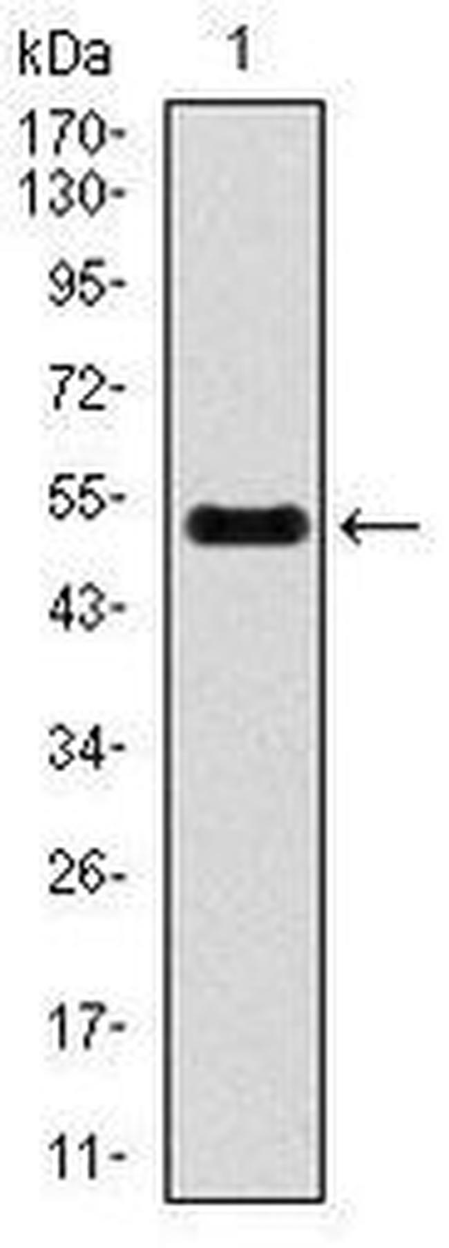INCENP Antibody in Western Blot (WB)