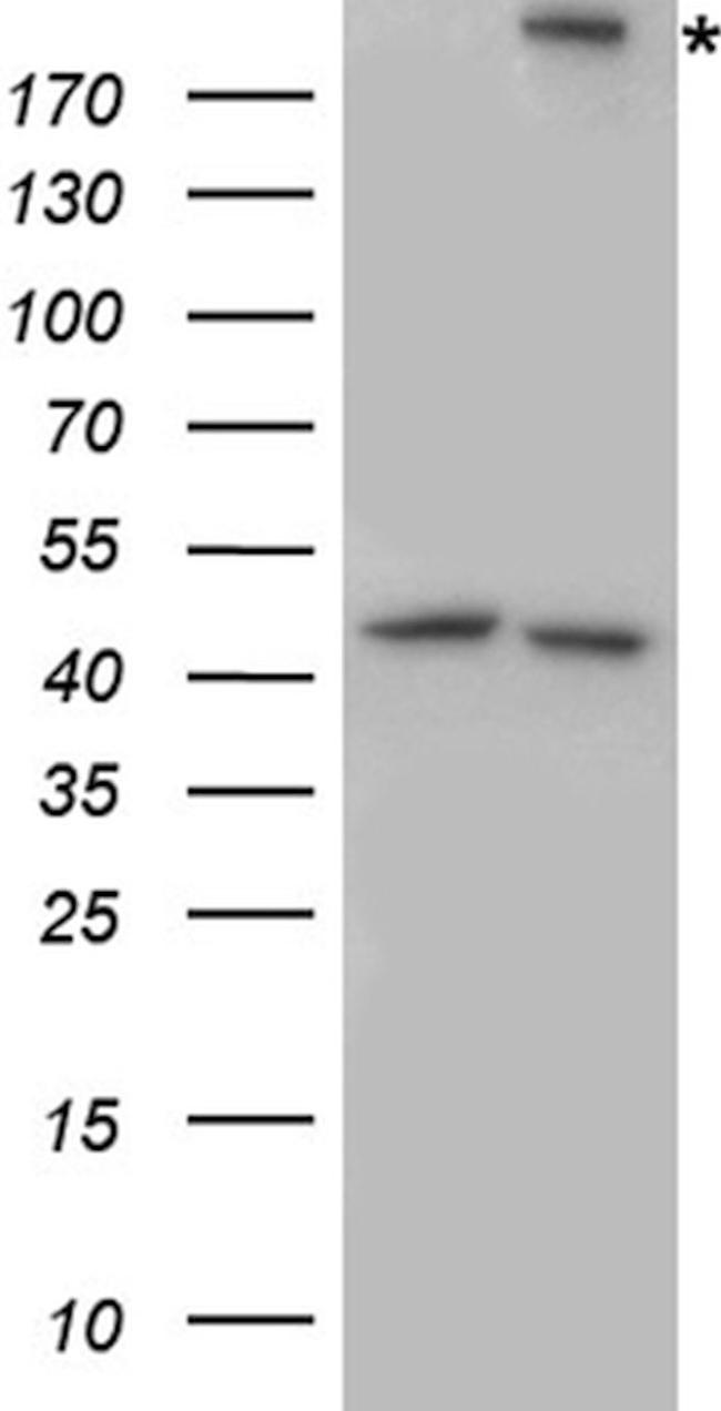 ITGB4 Antibody in Western Blot (WB)