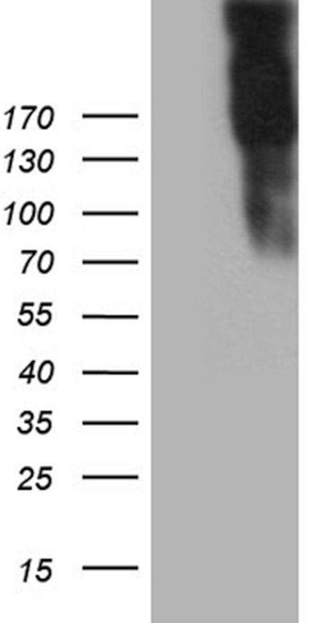 JAG1 Antibody in Western Blot (WB)