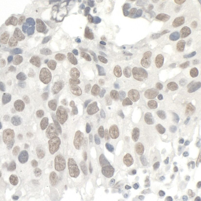 KAP-1 Antibody in Immunohistochemistry (IHC)