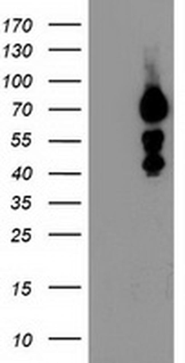 KATNB1 Antibody in Western Blot (WB)