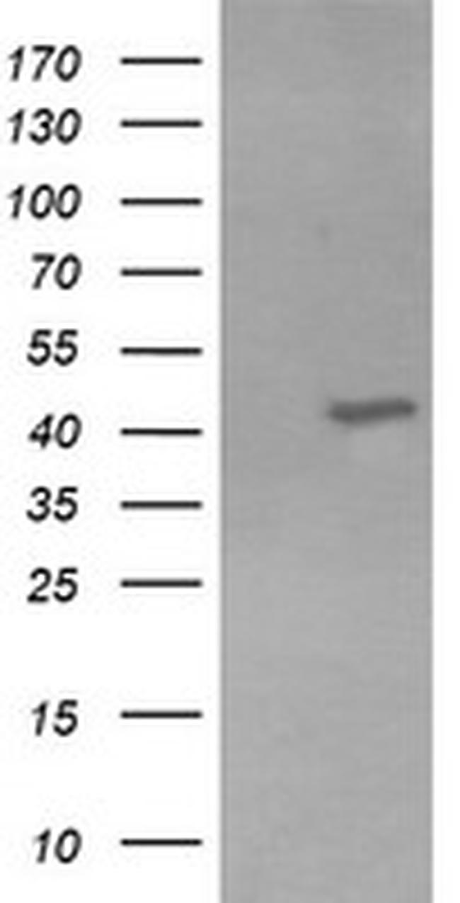 KCNAB1 Antibody in Western Blot (WB)