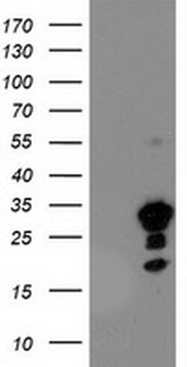 KIAA0495 Antibody in Western Blot (WB)