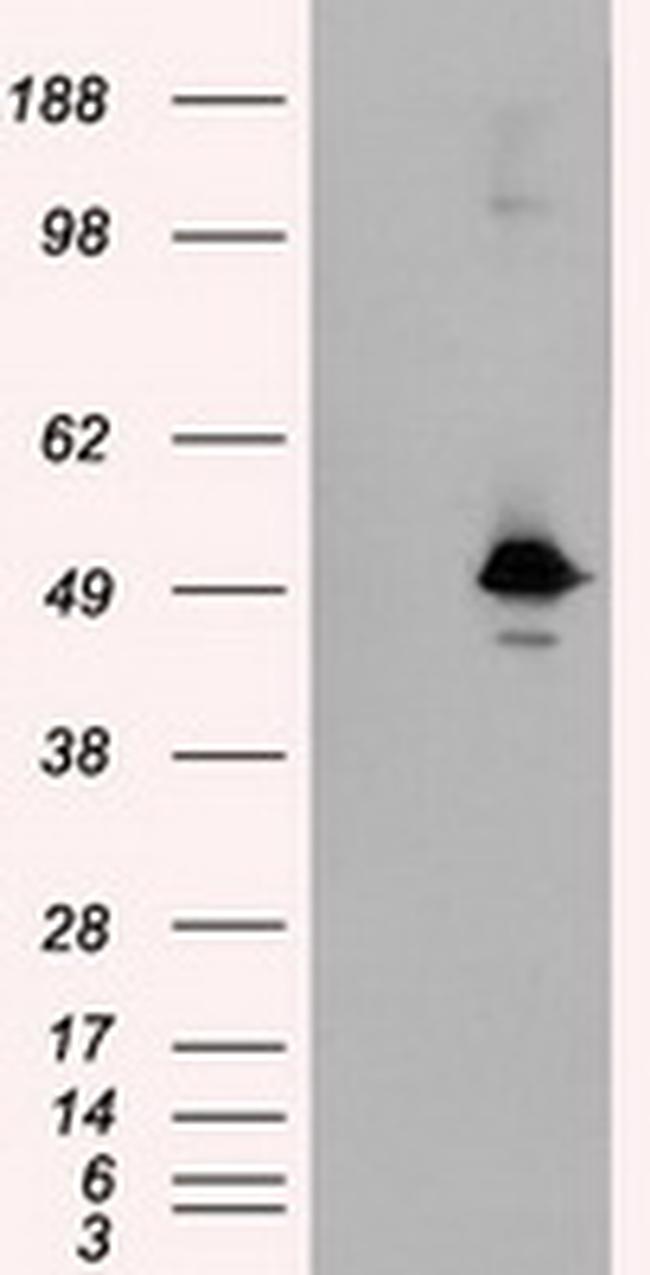 KIAA1609 Antibody in Western Blot (WB)