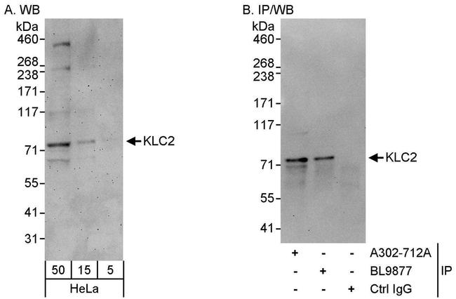 KLC2 Antibody in Western Blot (WB)