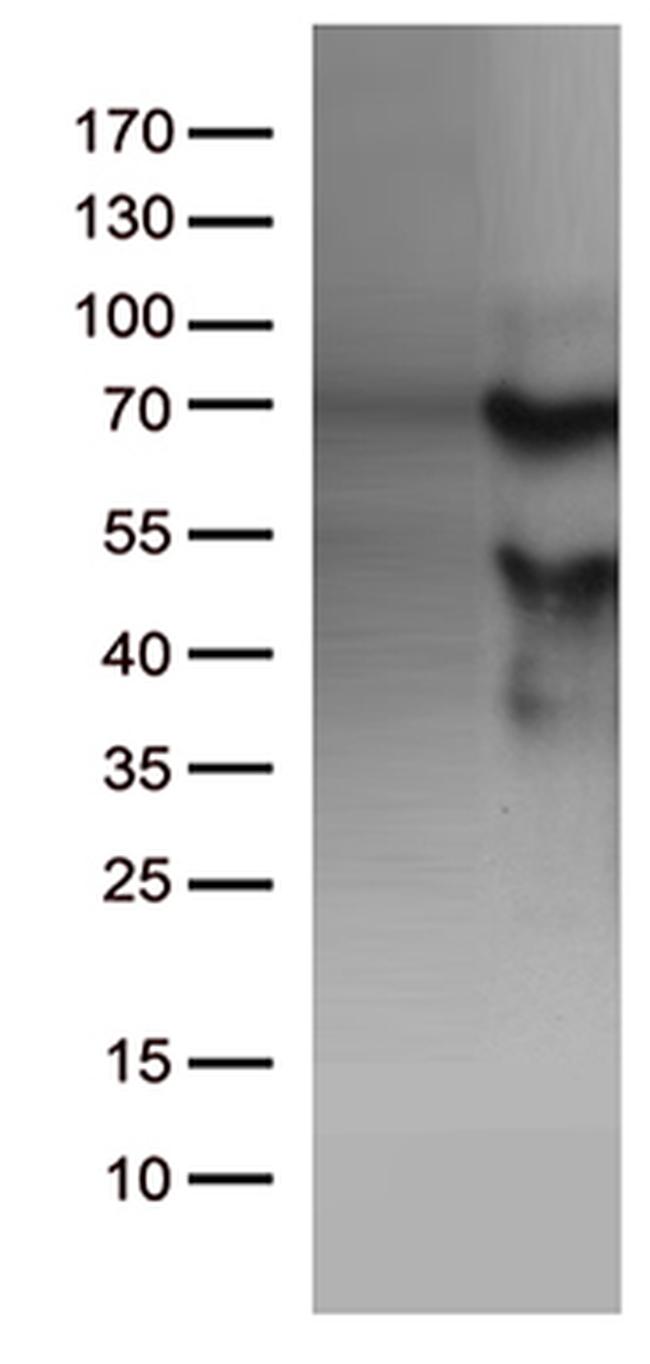 KLF11 Antibody in Western Blot (WB)