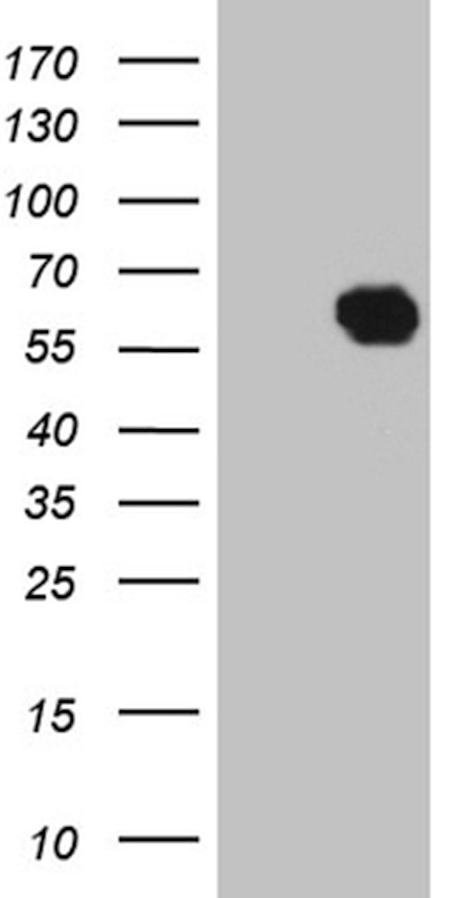 KLF12 Antibody in Western Blot (WB)