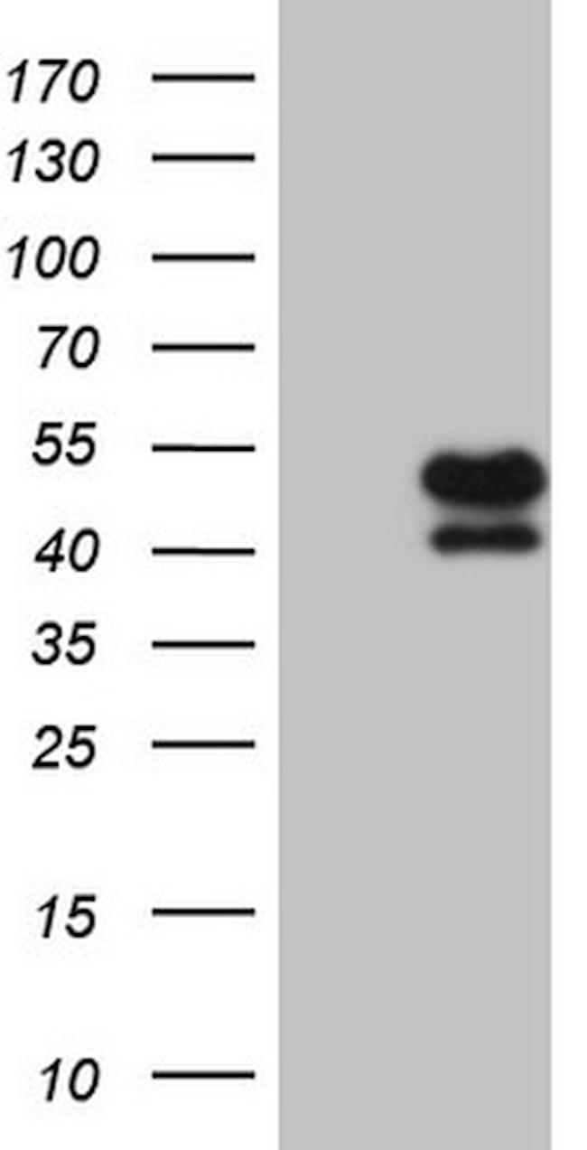 KLF2 Antibody in Western Blot (WB)