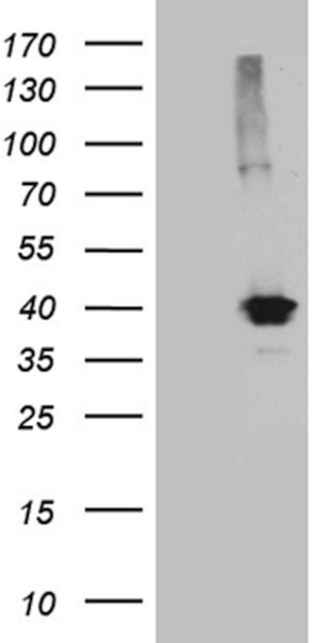 KLF7 Antibody in Western Blot (WB)