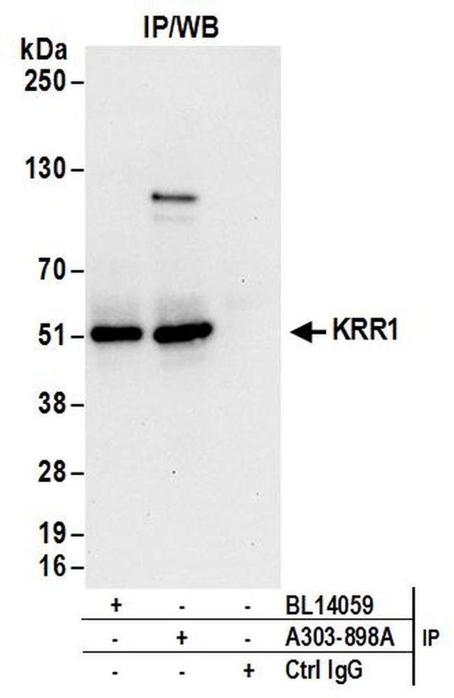 KRR1 Antibody in Western Blot (WB)