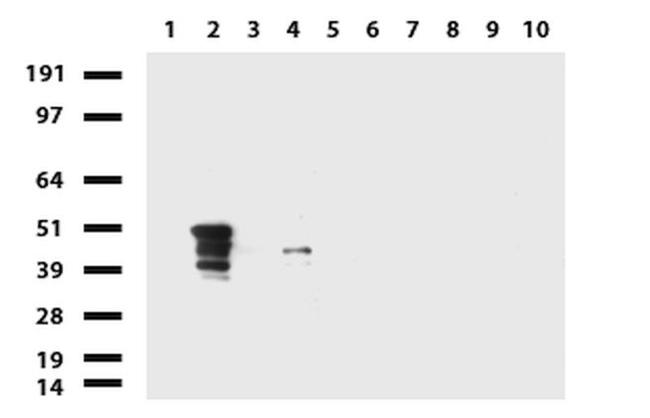KRT7 Antibody in Western Blot (WB)