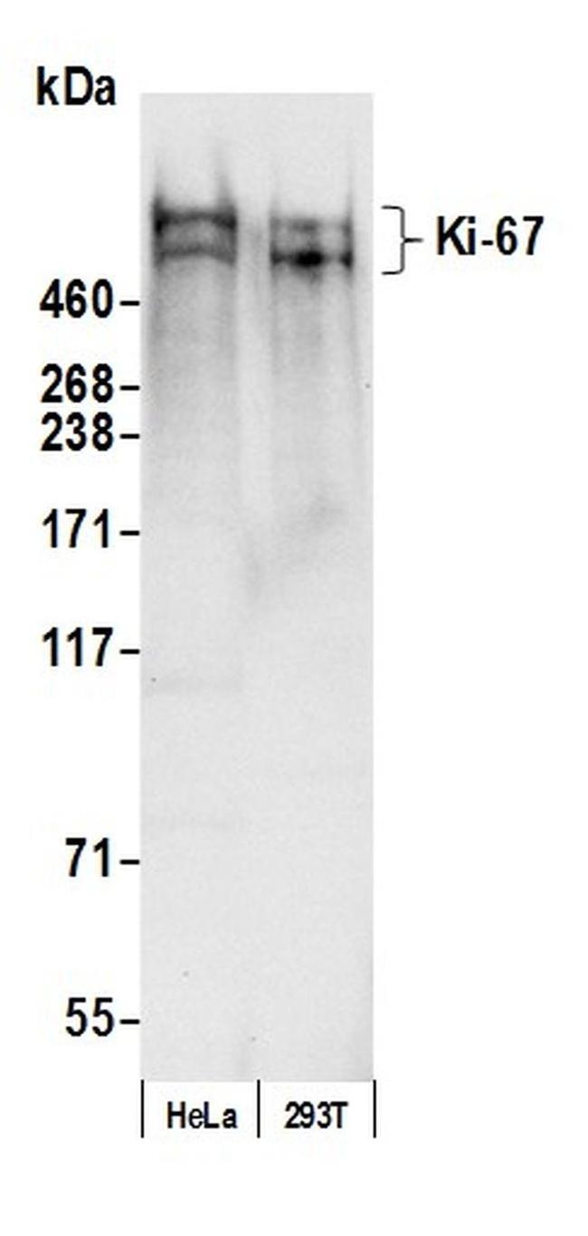 Ki 67 Recombinant Monoclonal Antibody