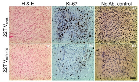 Ki67 Antibody in Immunohistochemistry (Paraffin) (IHC (P))