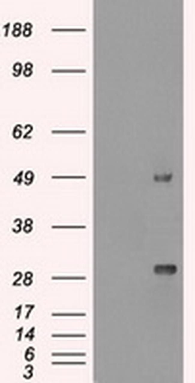 Ki67 Antibody in Western Blot (WB)