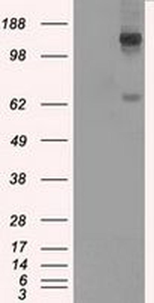 L1CAM Antibody in Western Blot (WB)