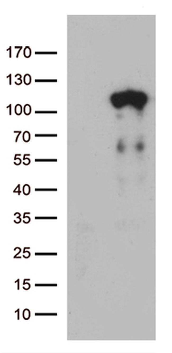 LCA5 Antibody in Western Blot (WB)