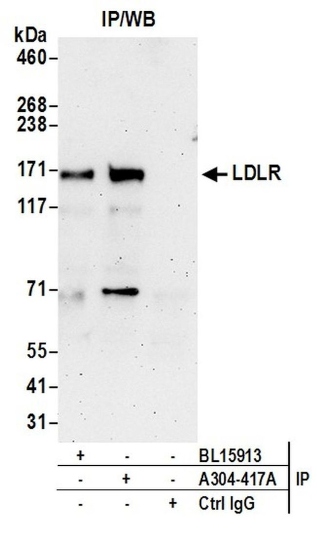 LDLR Antibody in Immunoprecipitation (IP)