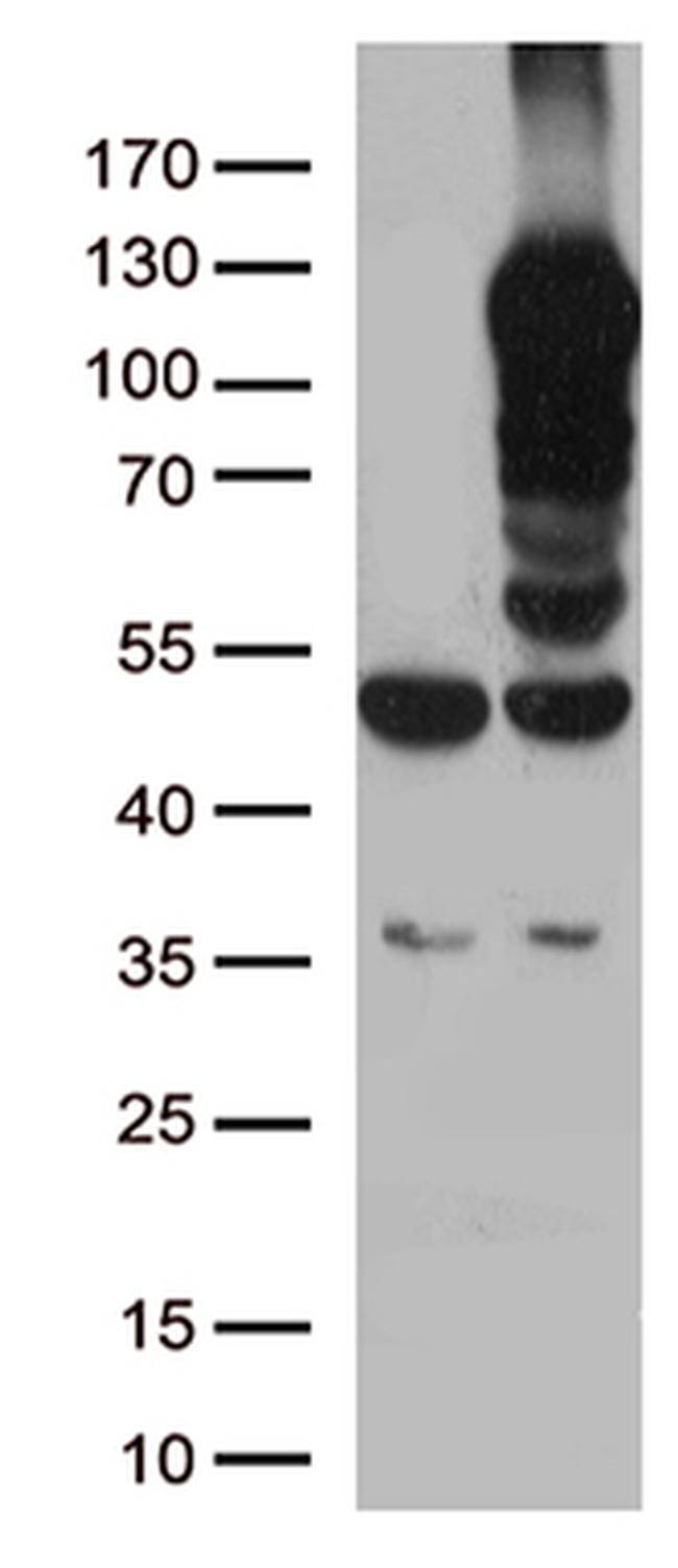 LEMD3 Antibody in Western Blot (WB)
