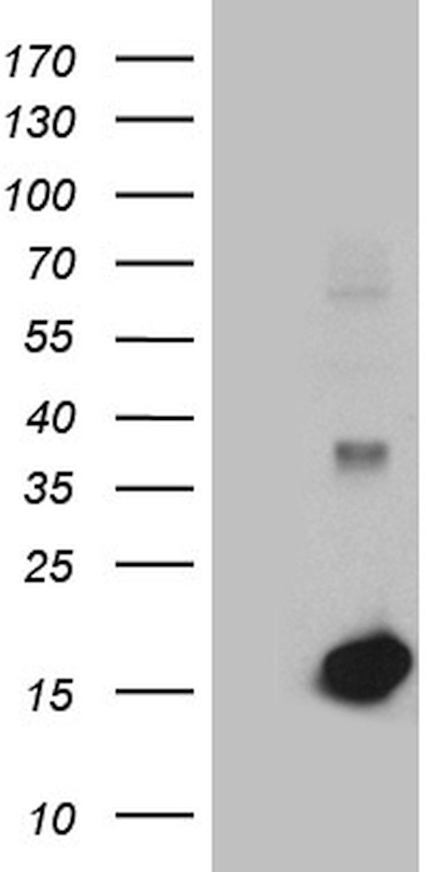 LGALS1 Antibody in Western Blot (WB)