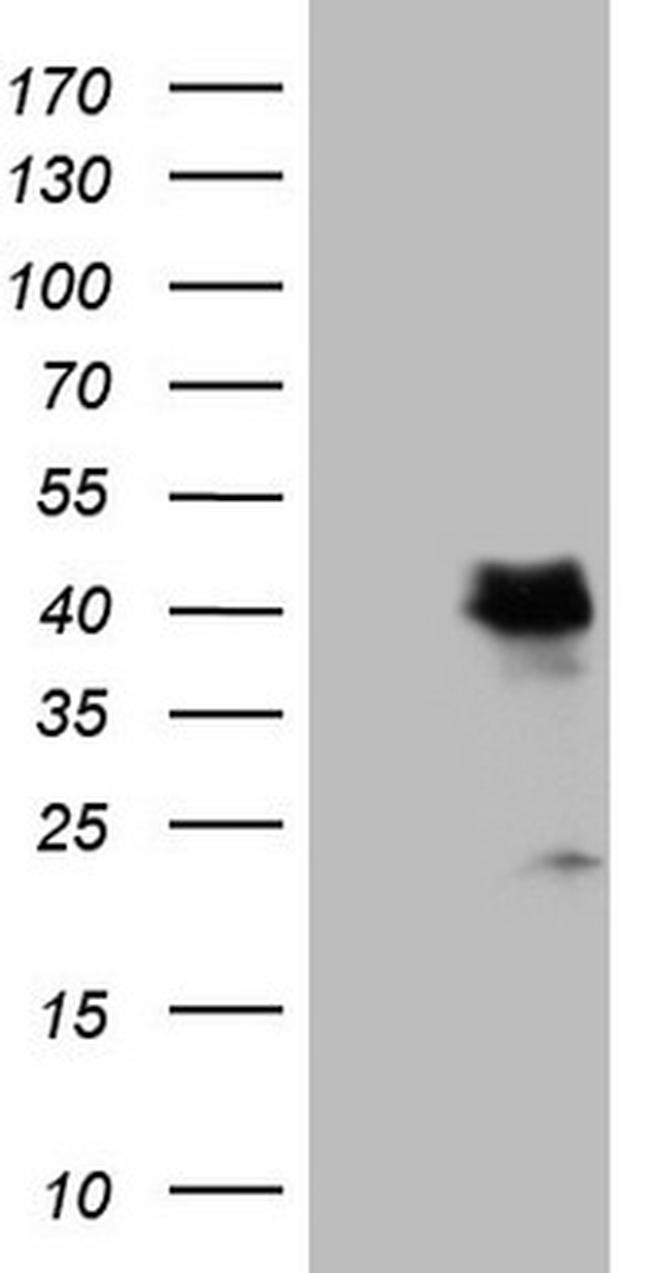 LGALS9 Antibody in Western Blot (WB)