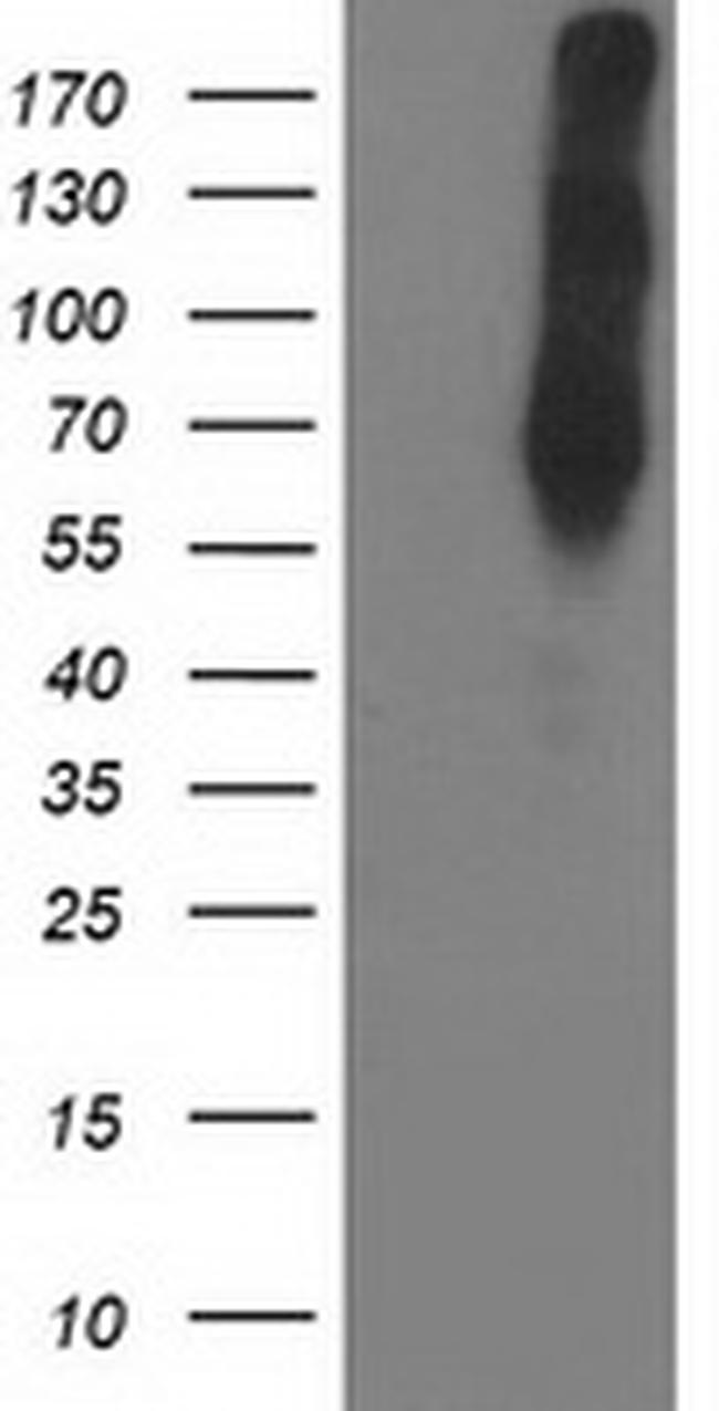 LIMK1 Antibody in Western Blot (WB)