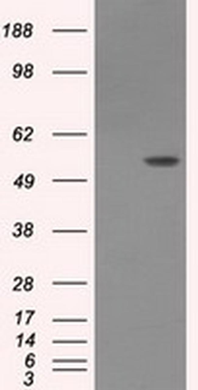 LIPG Antibody in Western Blot (WB)