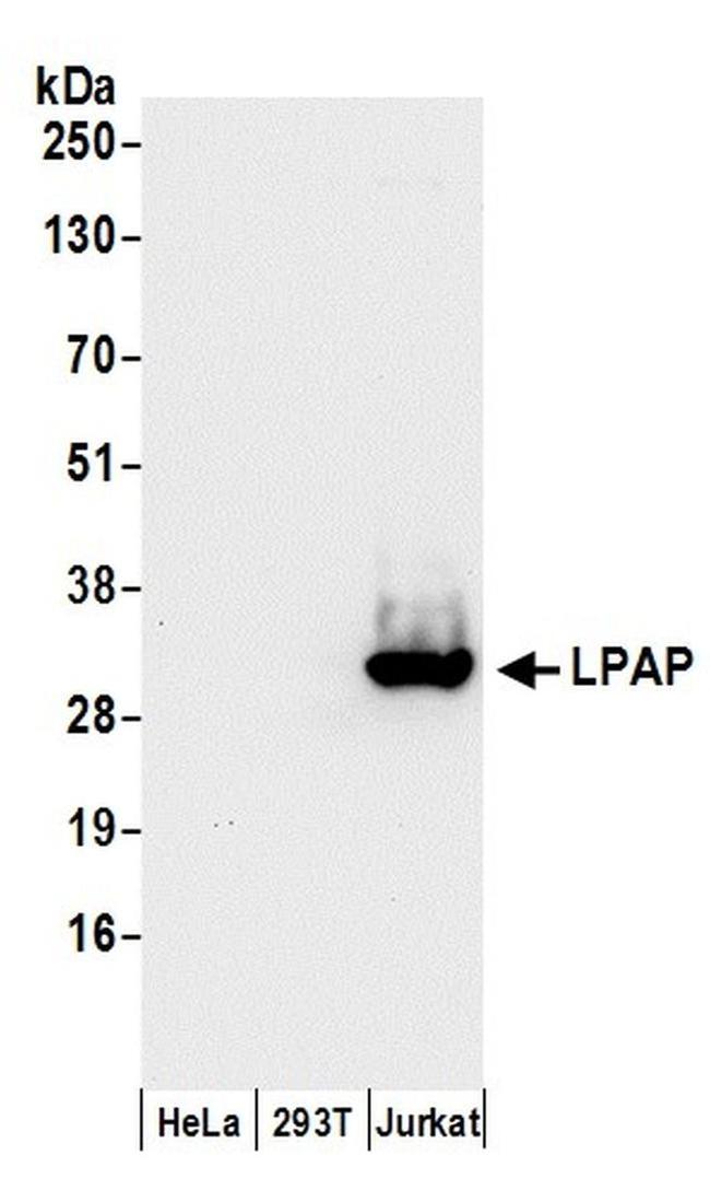 LPAP Antibody in Western Blot (WB)