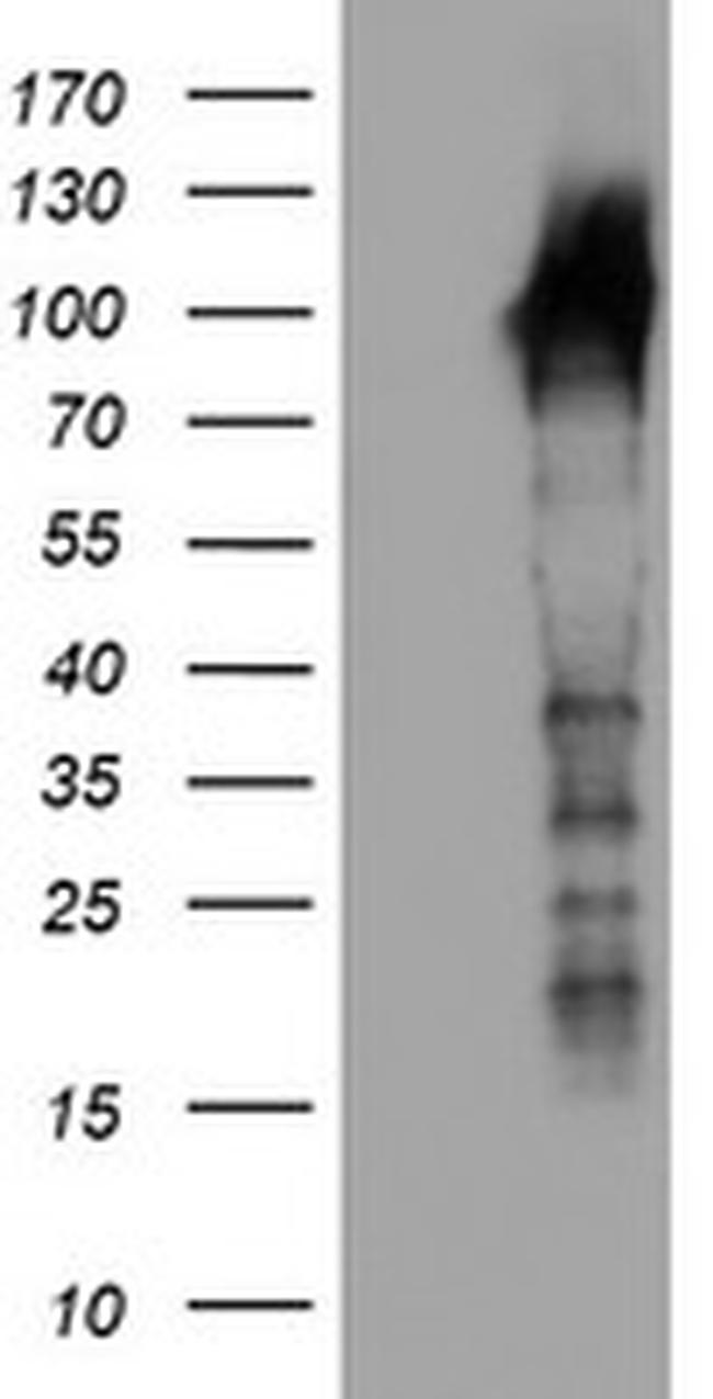 LRRC50 Antibody in Western Blot (WB)