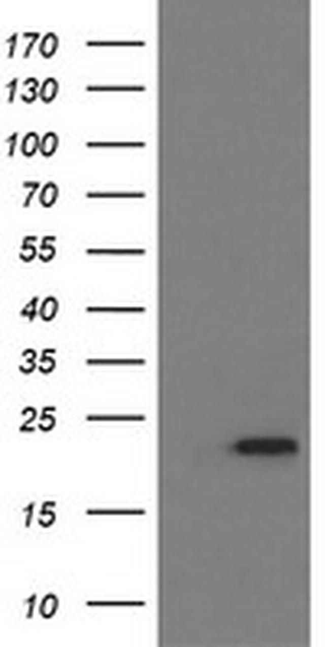 LZIC Antibody in Western Blot (WB)