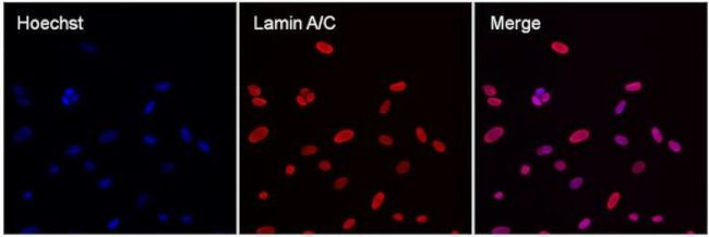 Lamin A/C Antibody in Immunocytochemistry (ICC/IF)