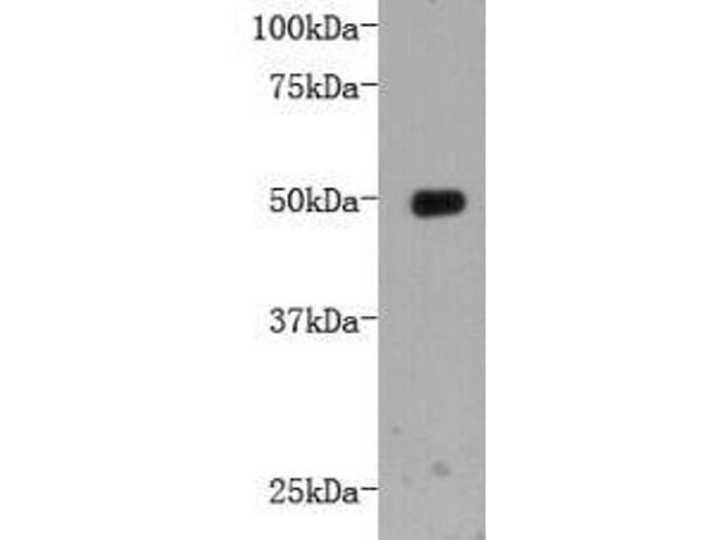 LRP-1 Antibody in Western Blot (WB)