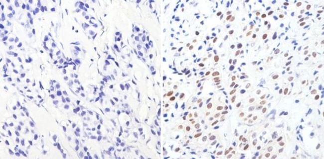 GATA3 Antibody in Immunohistochemistry (Paraffin) (IHC (P))