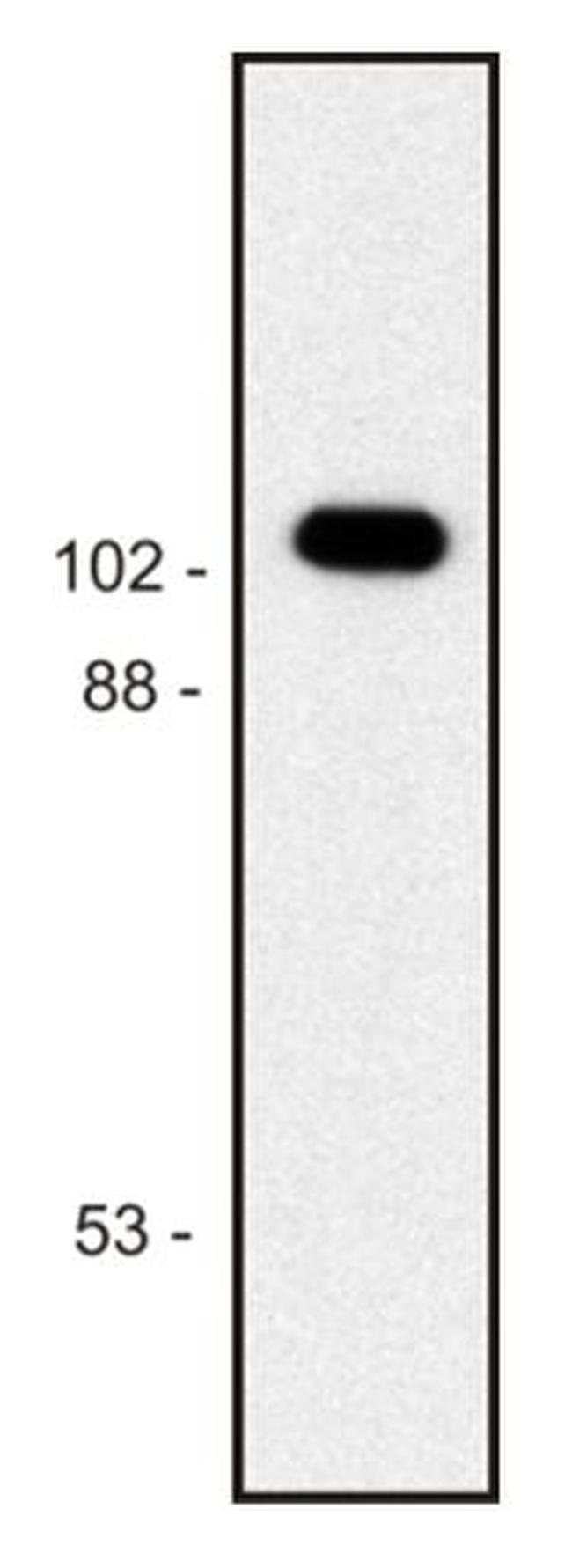 beta Galactosidase Antibody in Western Blot (WB)