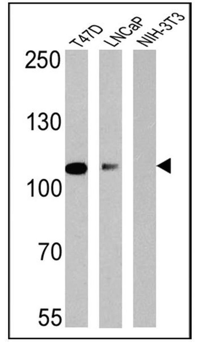 Androgen Receptor Antibody in Western Blot (WB)