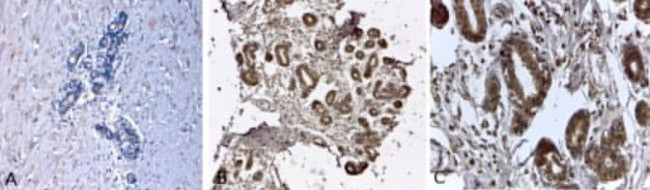 N-cadherin Antibody in Immunohistochemistry (Paraffin) (IHC (P))